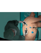 CHIRURGIE TORACICA